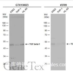 GeneTex TGF beta1 antibody