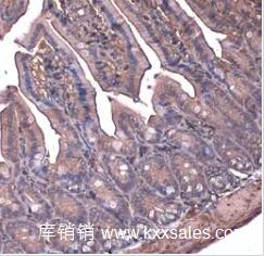 GeneTex beta Actin antibody 内参抗体